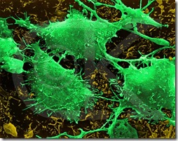 Cancer_cell