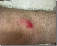 Left Knee