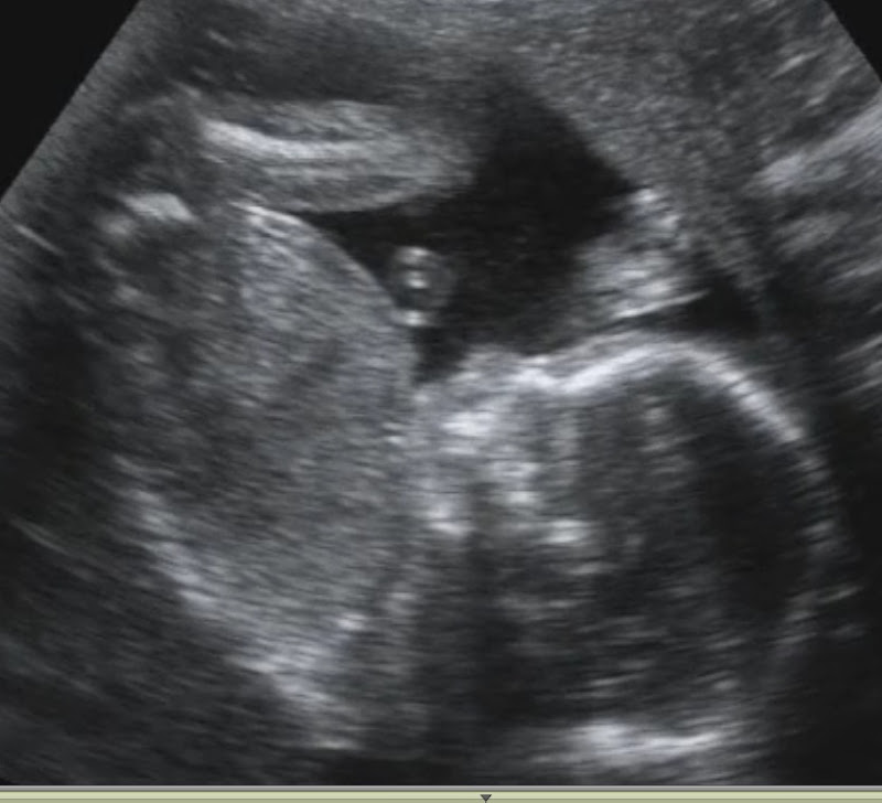 Picture 10.jpg