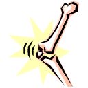 Hip fracture in women can be predicted