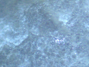skin tinea x200 top.jpg