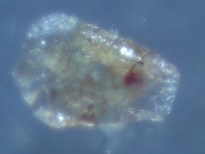 back lesion scab top.jpg