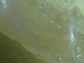 mucus fibers 60x 2.jpg