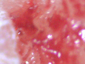 finger scrape  3 200x.jpg