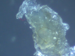 crusty w fibers 60x.jpg