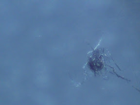 black speck fuzzball on skin 60x top.jpg