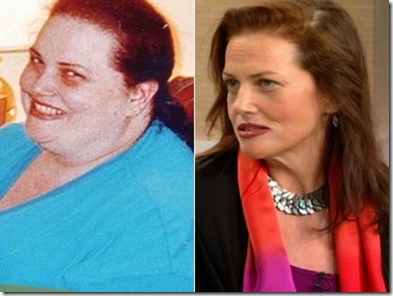 Nancy Makin Lose More Than 500 Pounds