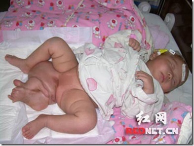 Two-month-old baby's bottom sprouted feet